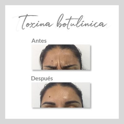 no invasivos_Mesa de trabajo 1